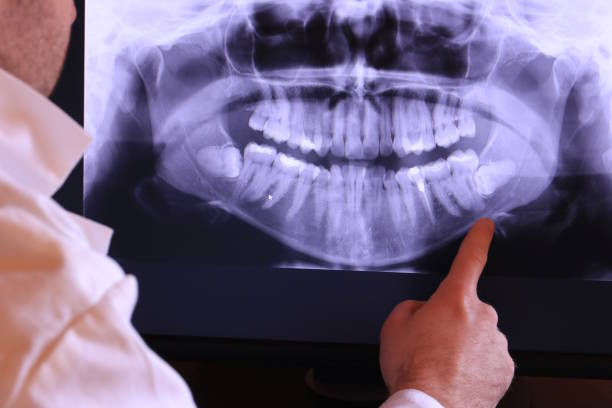 Best Pediatric Emergency Dentist in Fairmont, NC